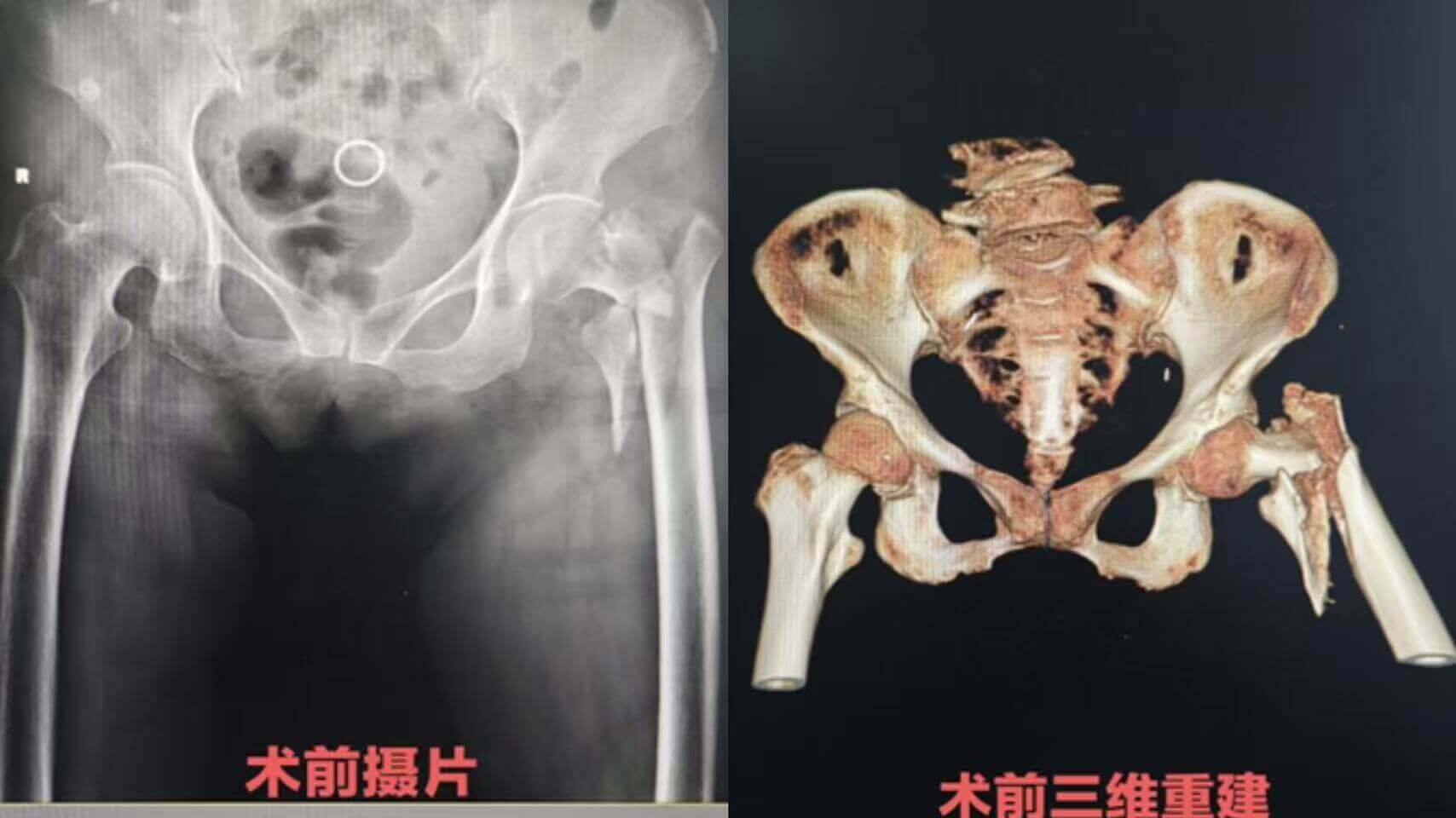 358a8a76385a27eb83b1aee48a1c4b4b 358a8a76385a27eb83b1aee48a1c4b4b