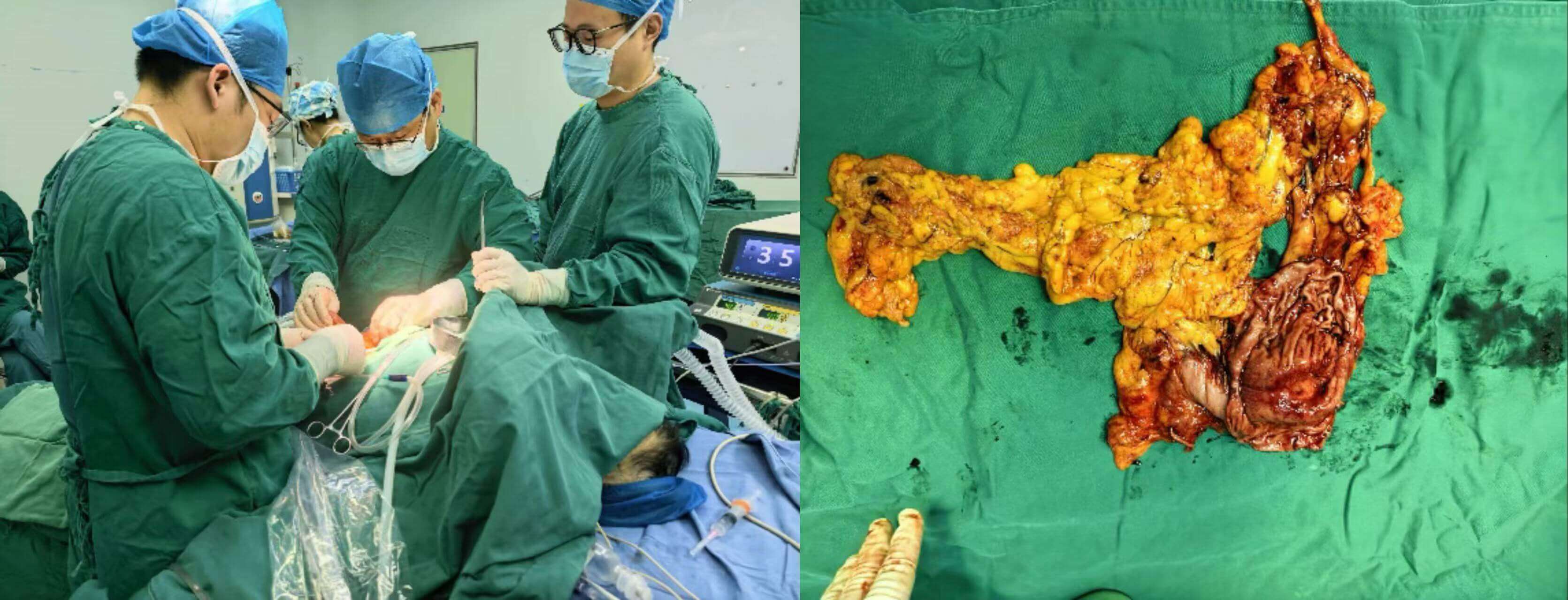 62ffe2e1945b5677752f5b0f8101f1d4 62ffe2e1945b5677752f5b0f8101f1d4