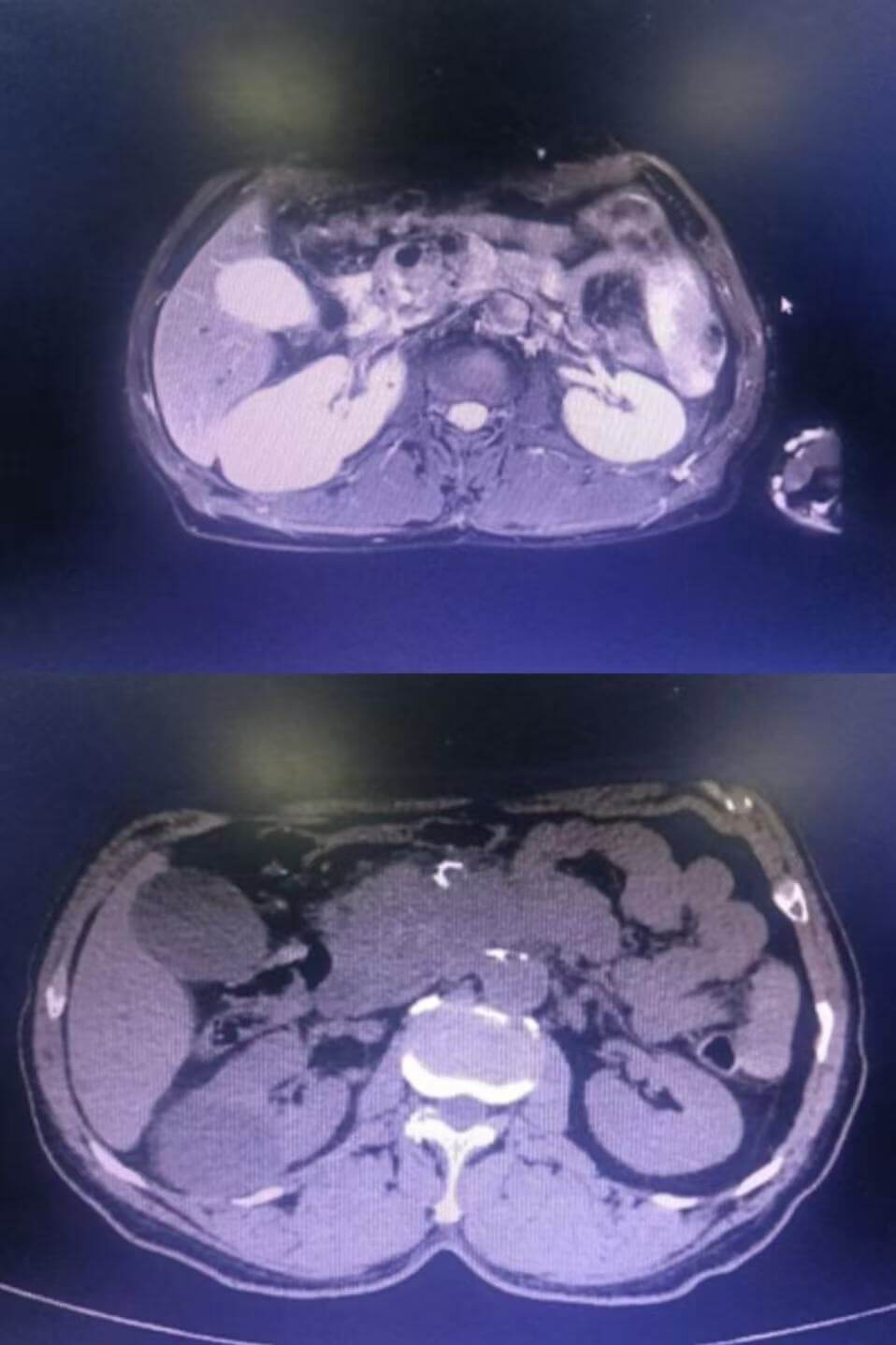 8ab1477b1c10bc992de3d3879b0aa77b