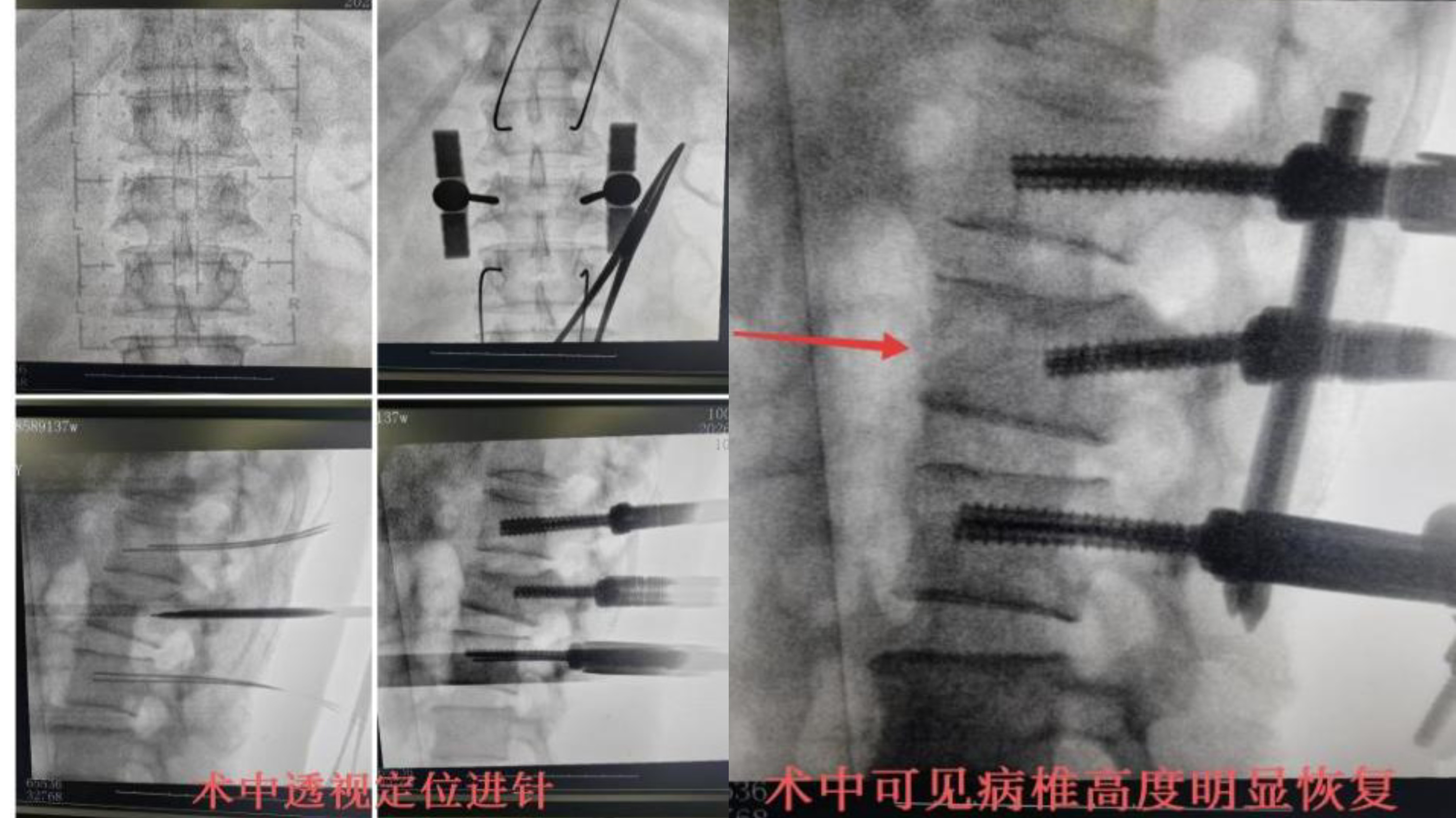 23f115cd3a3c5714d216dd2fa7156a04