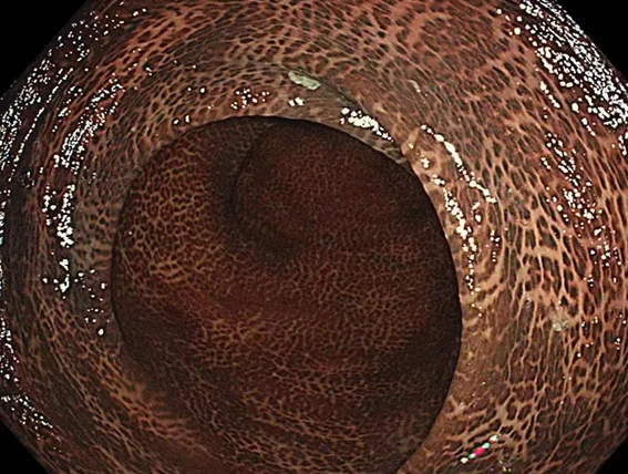 d113fb420d76f9ac0fab3fcbfc229fe2