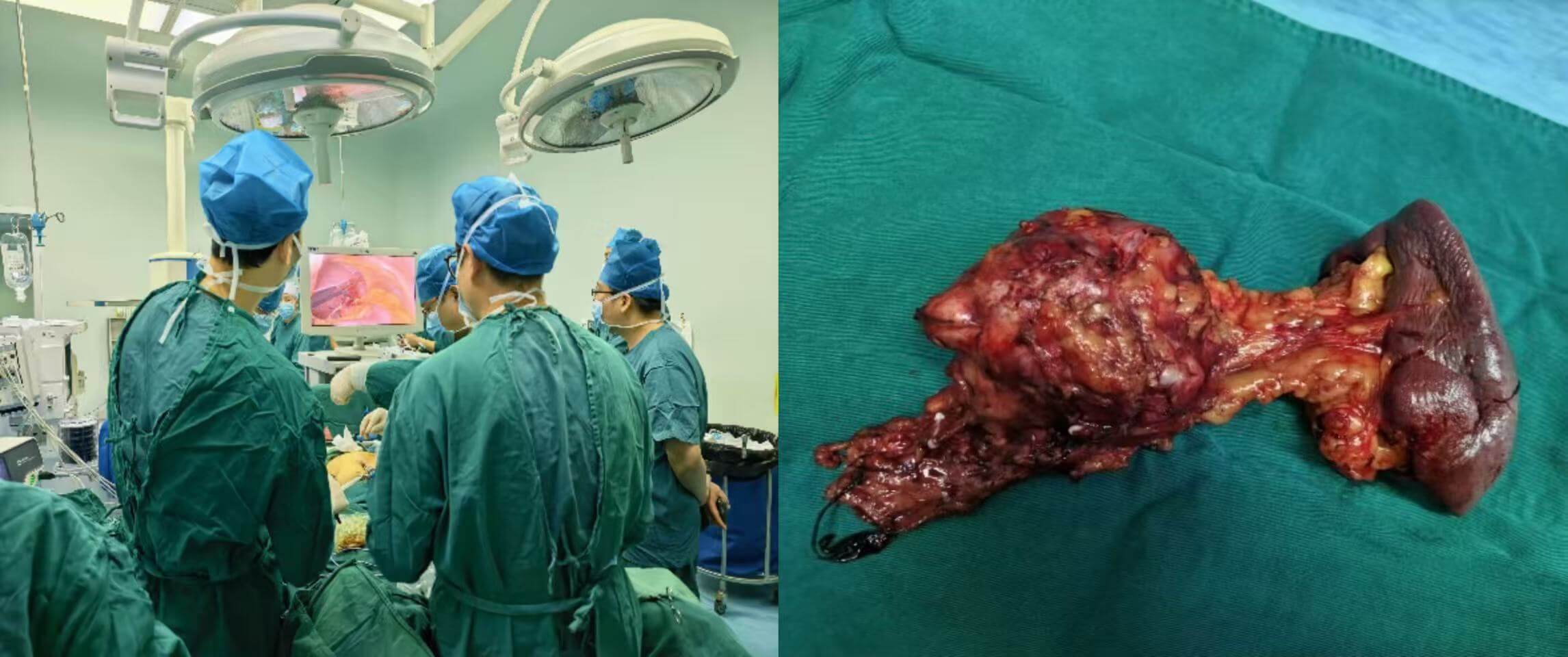 437e526170ba8933d4037bbdbcd83072 437e526170ba8933d4037bbdbcd83072