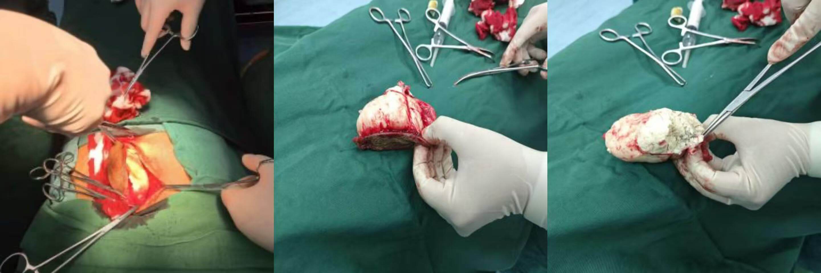 1dd76b6988301e0b2e012b33471082d3